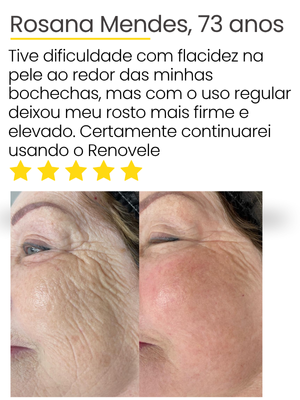 depoimento
