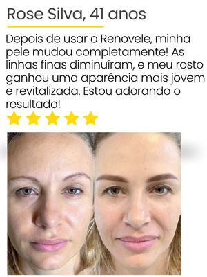 depoimento