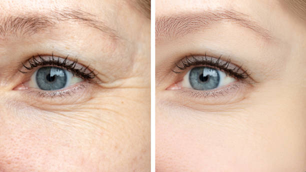 Antes e depois