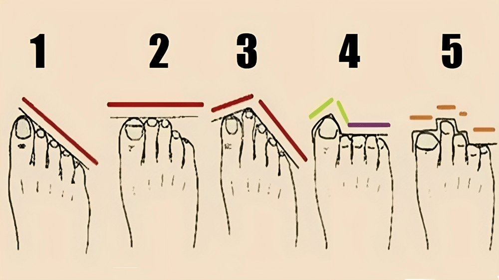 cinco tipos diferentes de formatos de pés